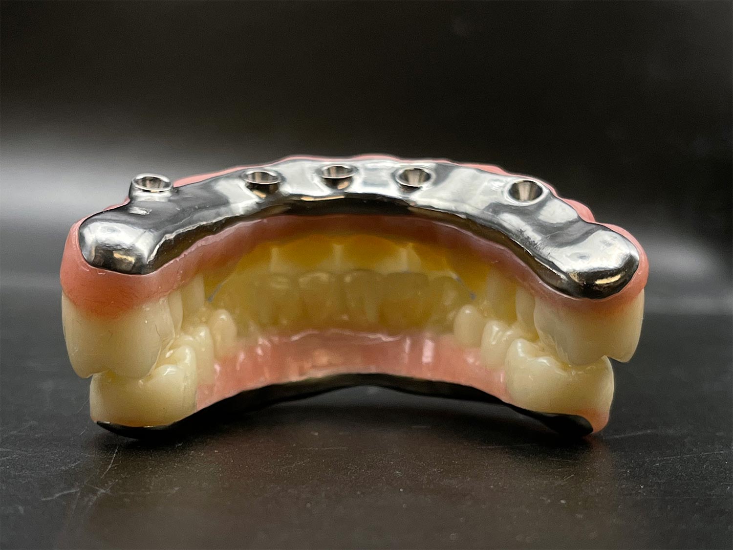 PMMA Provisional Restoration Hybrid PMMA Dental Bridge milled pink or acrylic no teeth debonding
