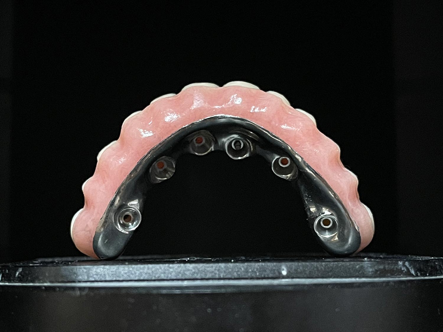 PMMA provisional restoration hybrid dental bridge milled pink or acrylic