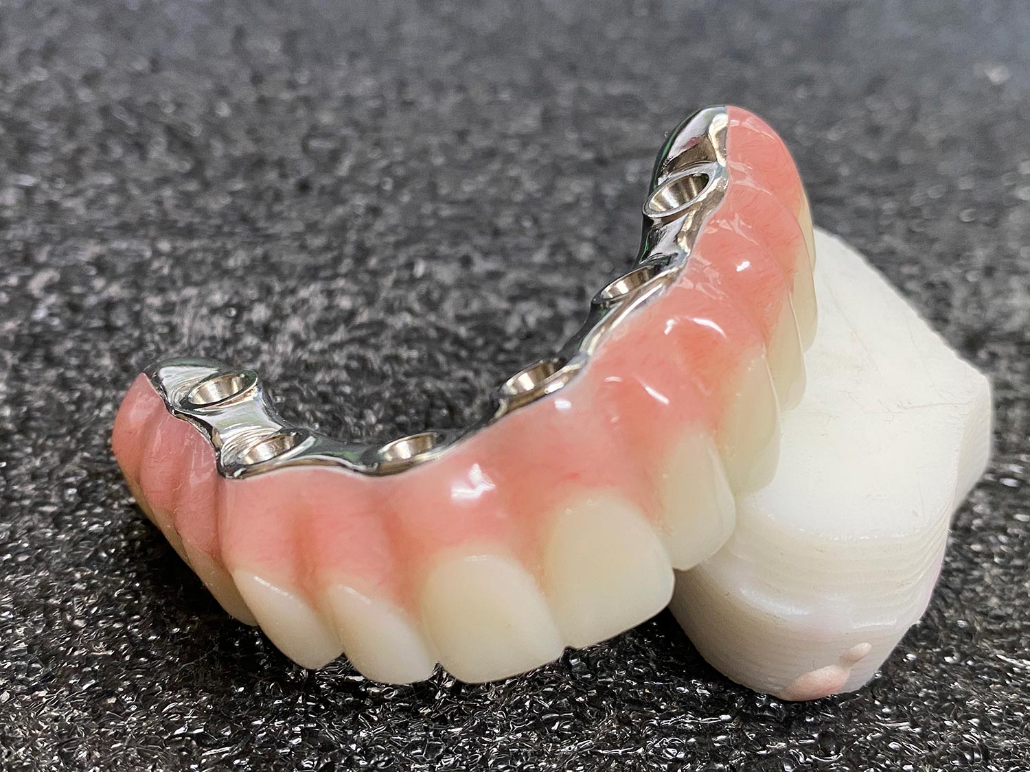 zirconia full contour fixed dentures implants bridge hygienic bar