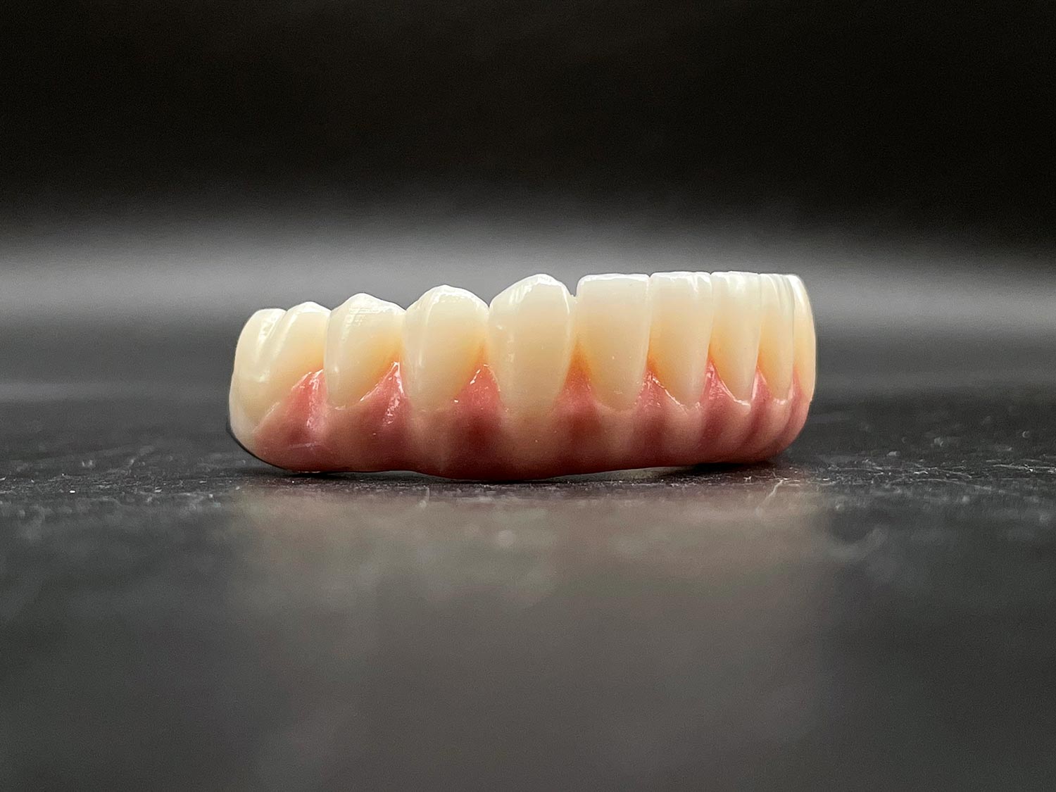 zirconia full contour fixed dentures implants